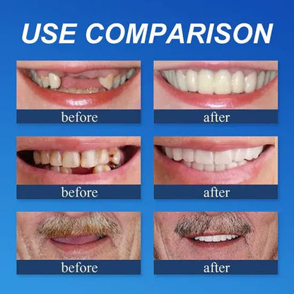 🌎Ends Today: 70% OFF! ⏰meleval® Medical Full Denture with Strong Suctiond🦷Obtain American Dental Association (ADA) Certification