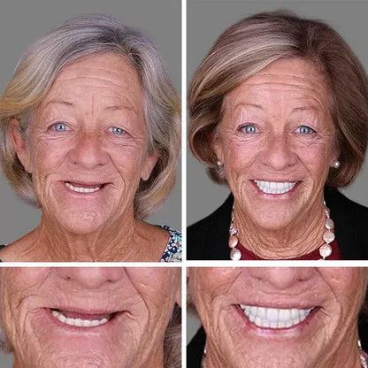 🌎Ends Today: 70% OFF! ⏰meleval® Medical Full Denture with Strong Suctiond🦷Obtain American Dental Association (ADA) Certification